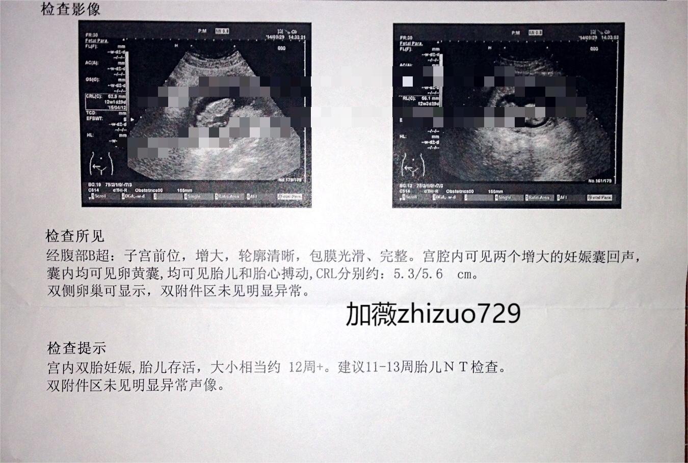 老公因为没有孩子疏远我怎么办？